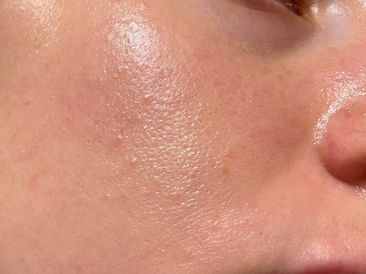 Oily