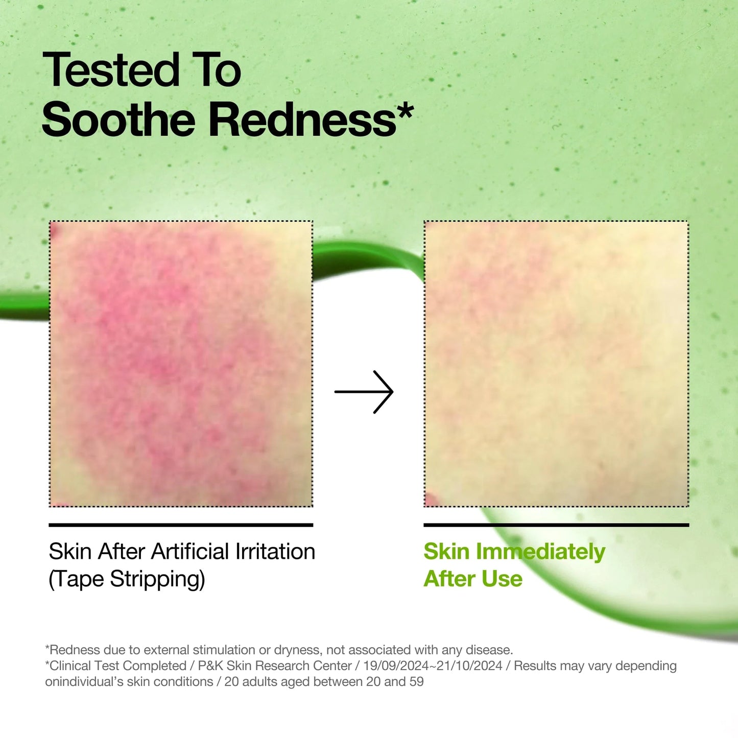 Anua 10+ Azelaic Acid + Hyaluron Acid Serum
