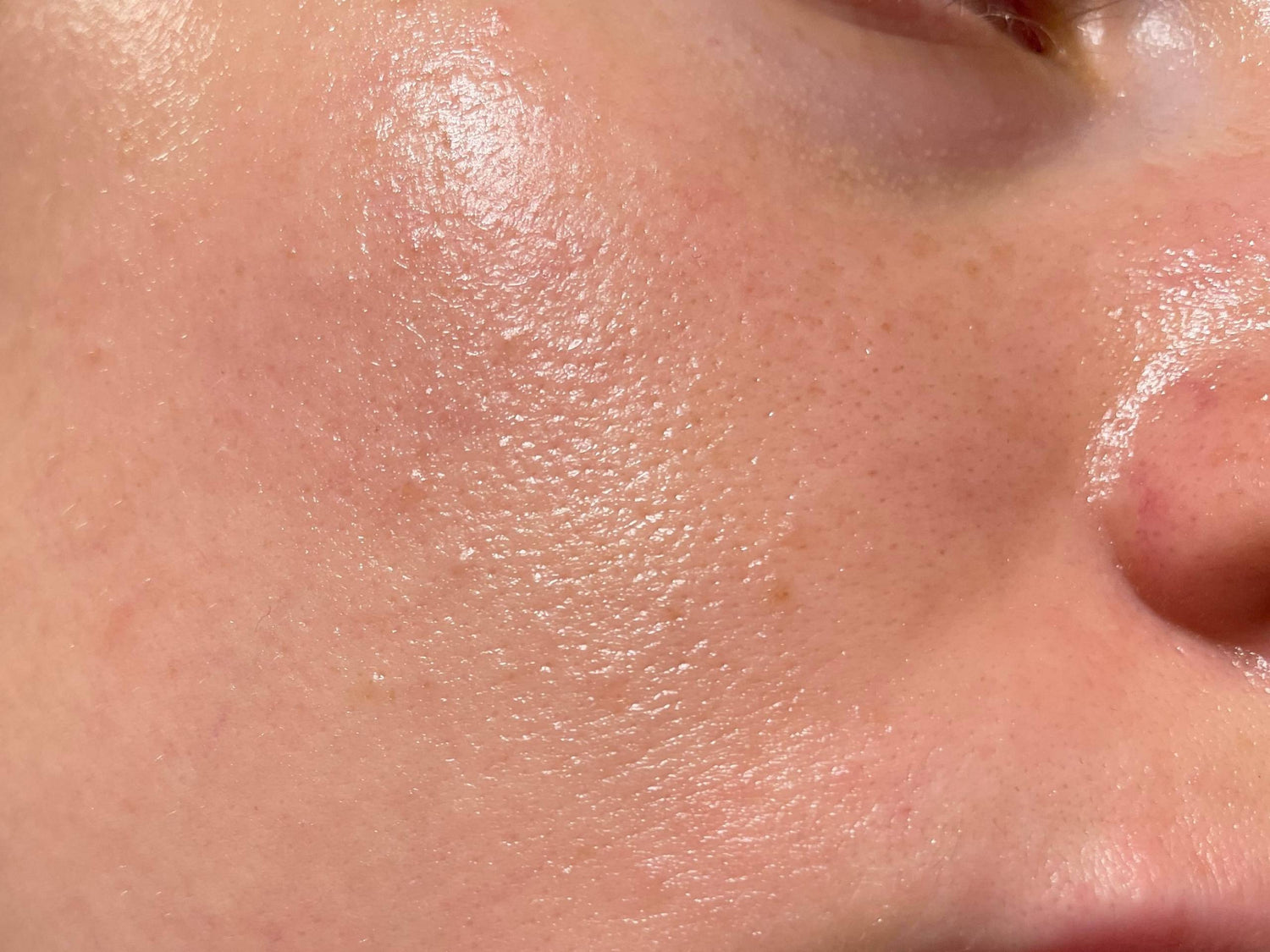 Oily