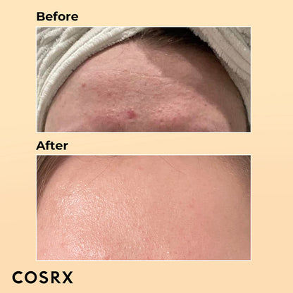 Cosrx The Retinol 0.5 Oil