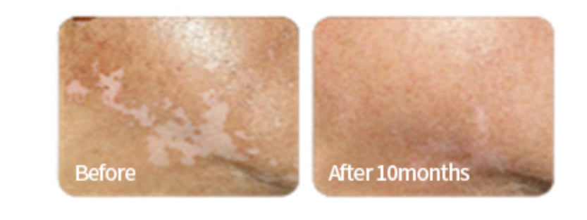 SkinMD Laboratories Revimela Barrier Cream 70ml