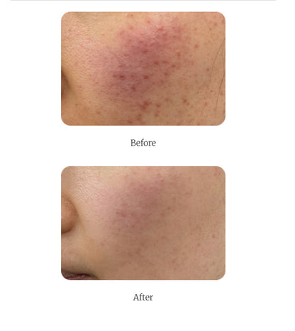 Skinmd Laboratories Revigel Pro Skin Protectant System Centellica 44% 50ml