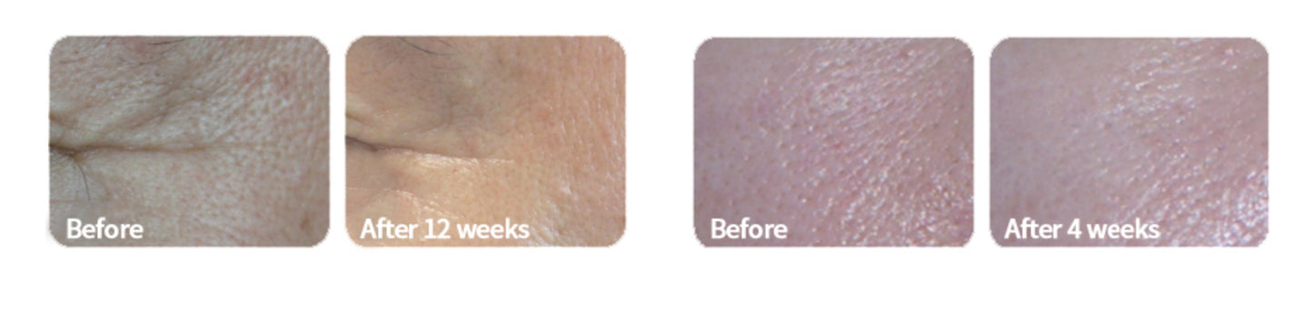 SkinMD Laboratories Revitox Peptide Cream 50g