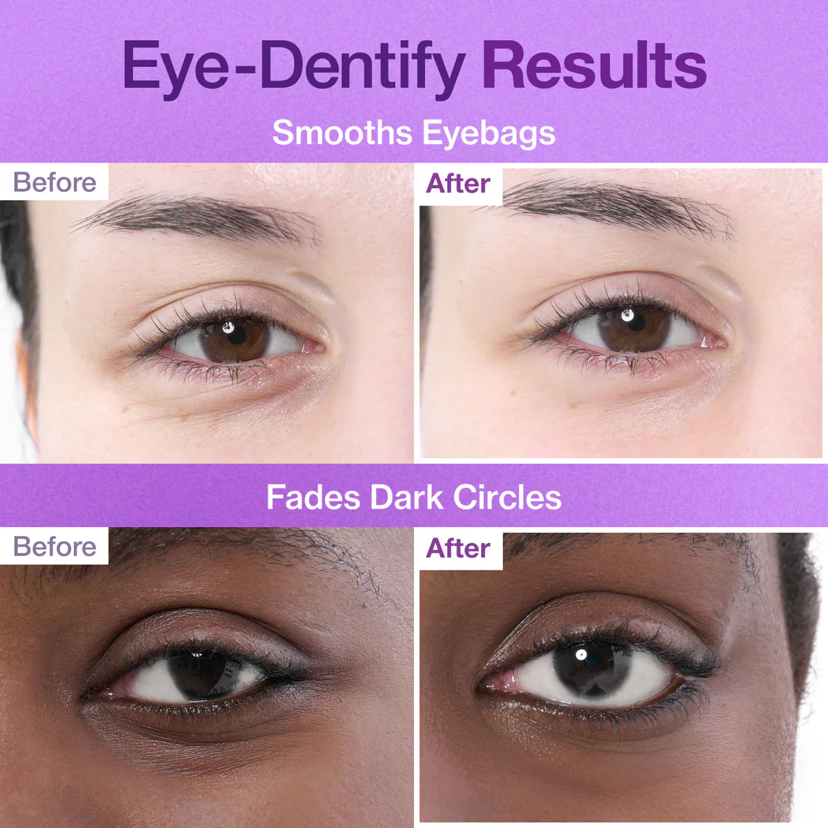 Numbuzin NAD+ Collagen Under Eye Patches 9+ (8g)