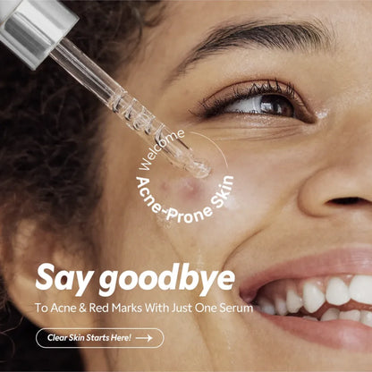 Tirtir Azelaic Acid 12% Serum 30ml